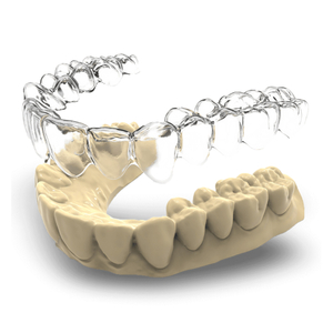 Glorysmile Orthodontic Braces Private Customization Service, Invisible Aligner